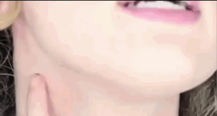 Thumbnail 13